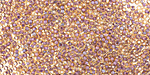 TOHO Light Topaz (with Opaque Lavender Lining) Round 15/0 Seed Bead